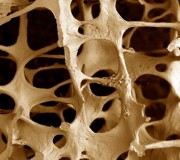 osteo osteo