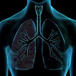 X-ray of lungs