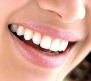 sorriso